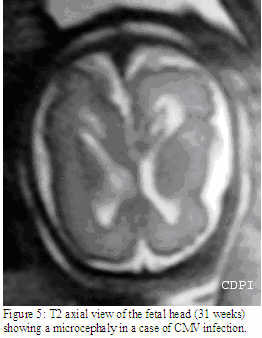 fig5