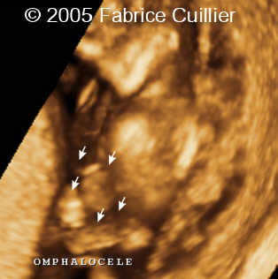 fig5