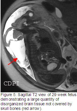 fig5
