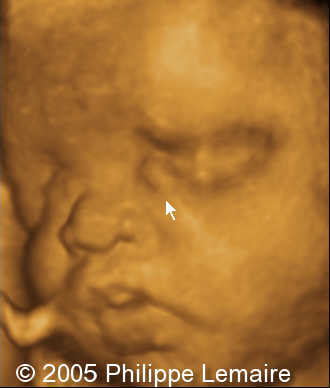 fig5