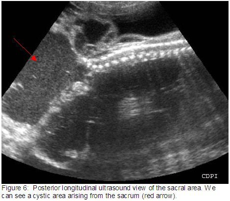 fig6