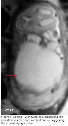 fig6