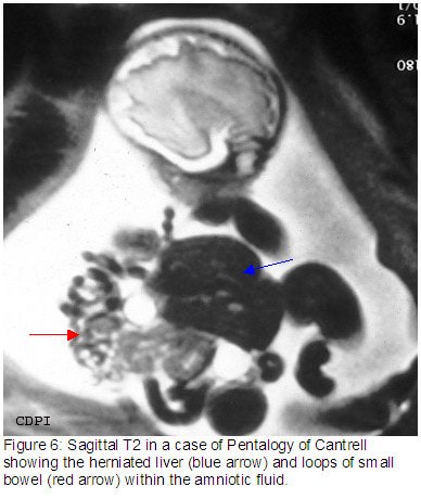 fig6