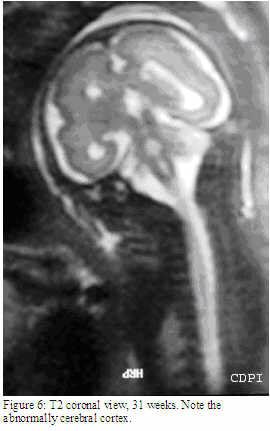 fig6