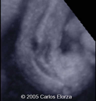 fig6