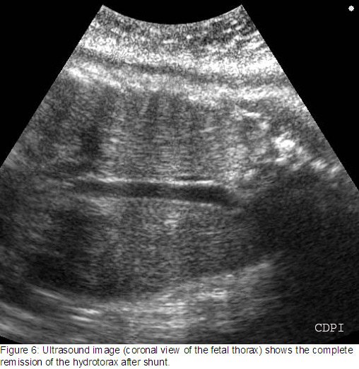 fig6