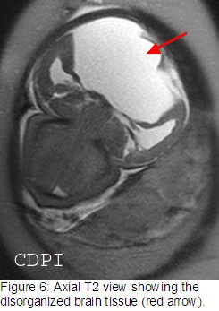 fig6