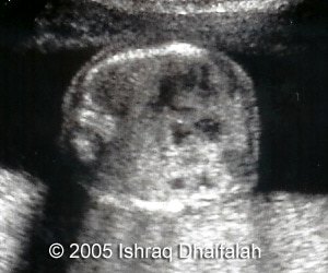 fig6