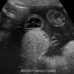 fig6