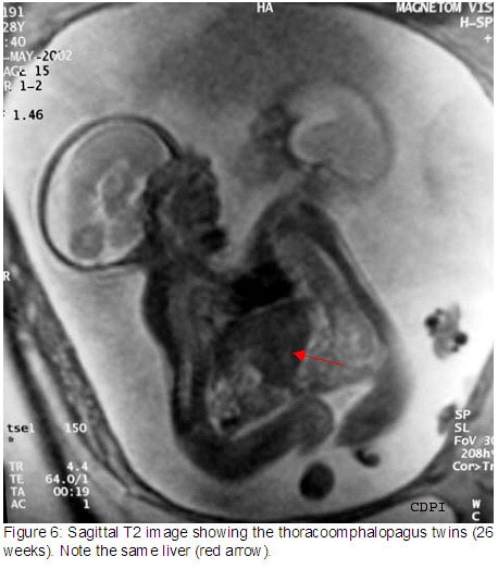 fig6