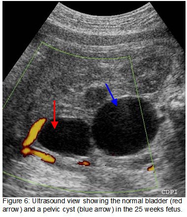 fig6