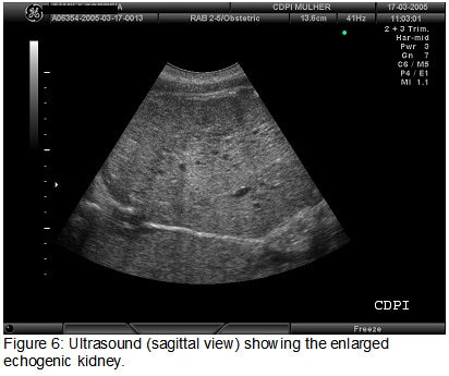 fig6