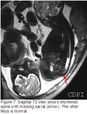 fig7