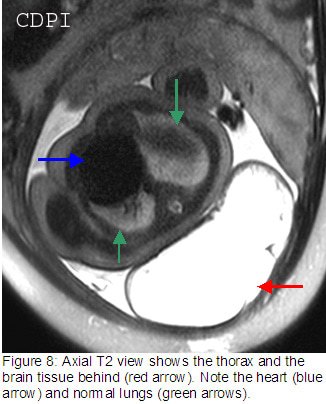 fig8