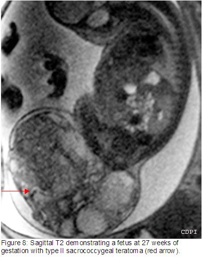 fig8