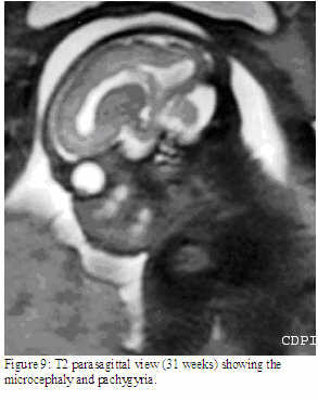 fig9