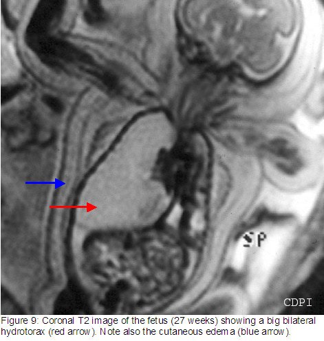 fig9