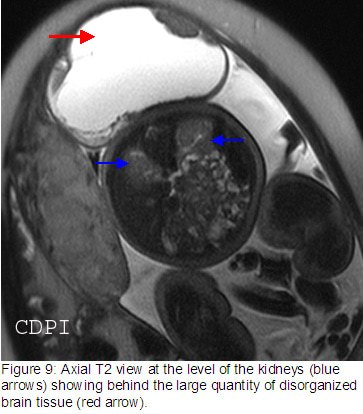 fig9