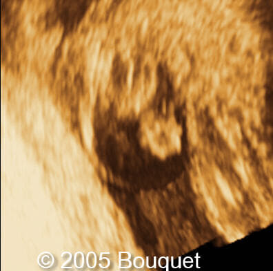 Fig9