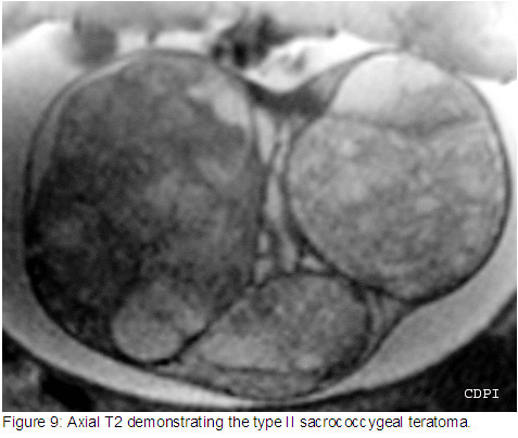 fig9