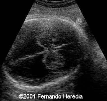 figure 8