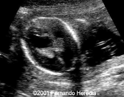 figure 8