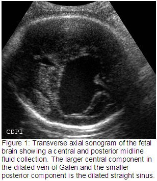 Figure1