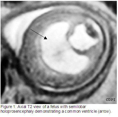 Figure1