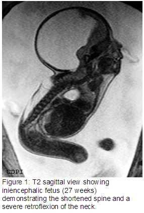 Figure1
