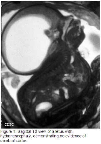 Figure1