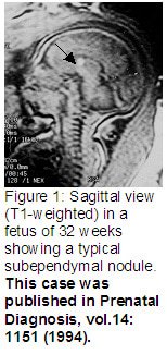 Figure1