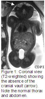 Figure1