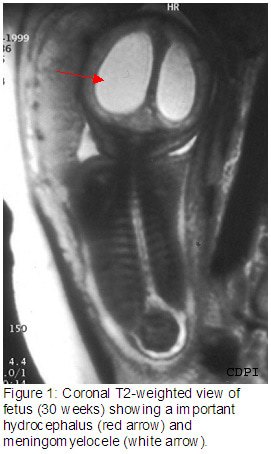 Figure1