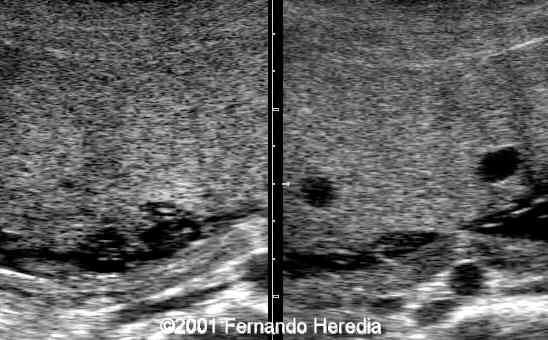 figure1