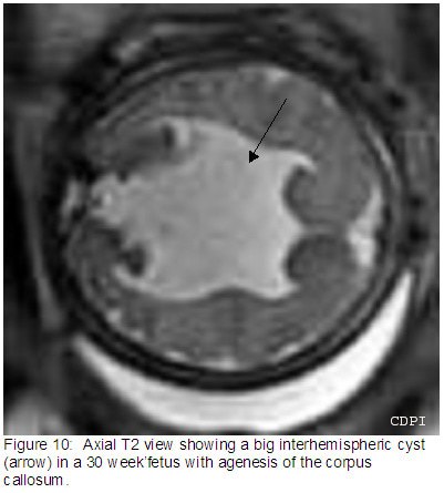 Figure10