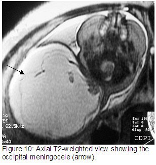 Figure10