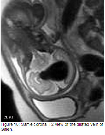 Figure10