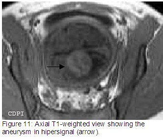 Figure11