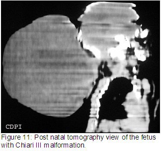 Figure11
