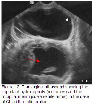 Figure12