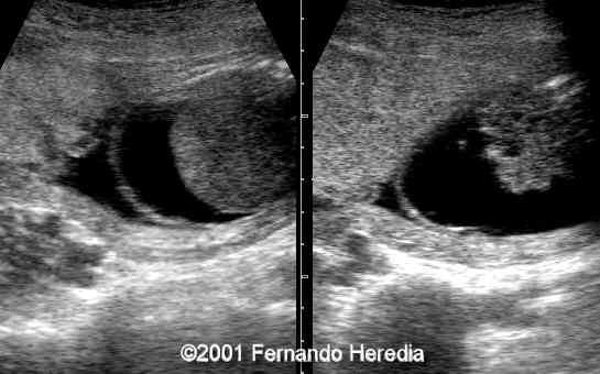 figure12