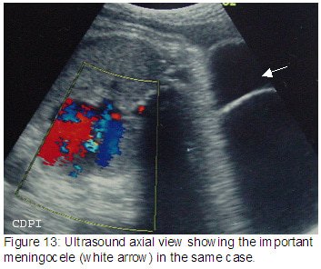 Figure13