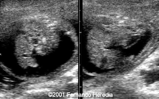 figure13