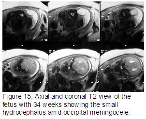 Figure15