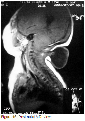 Figure16