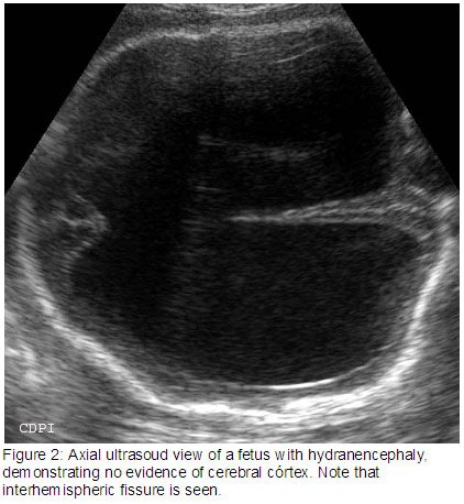 Figure2