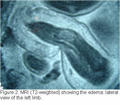 figure2