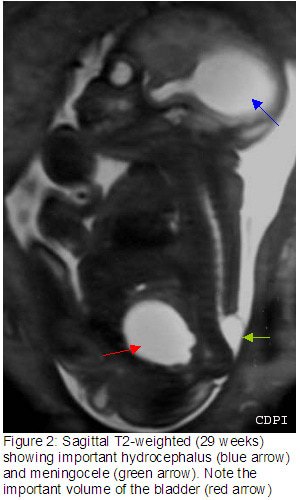 Figure2