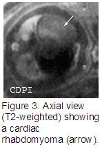 Figure3
