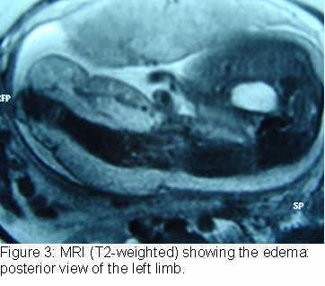 figure3